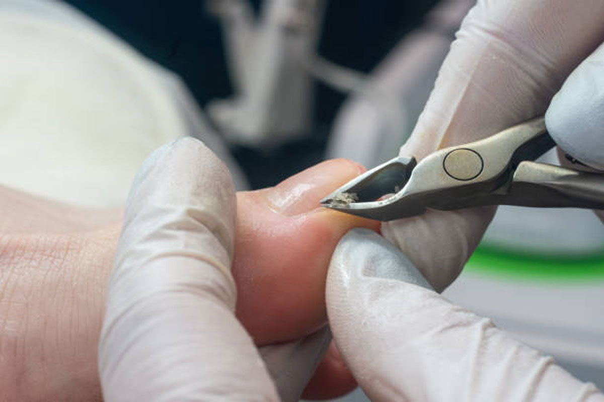 Cuticle Nippers